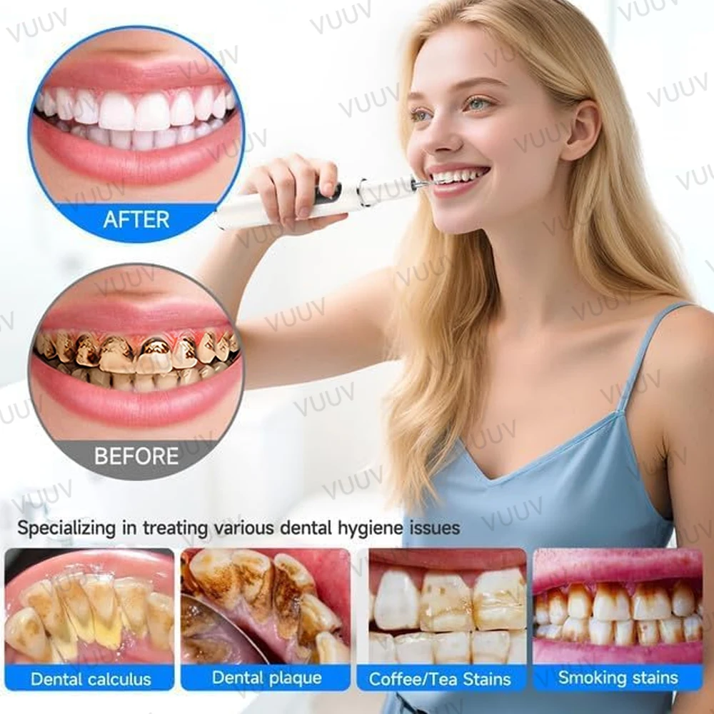 VUUV Pulitore Dentale a Ultras - Teeth Whitening Uv recensione e prezzo