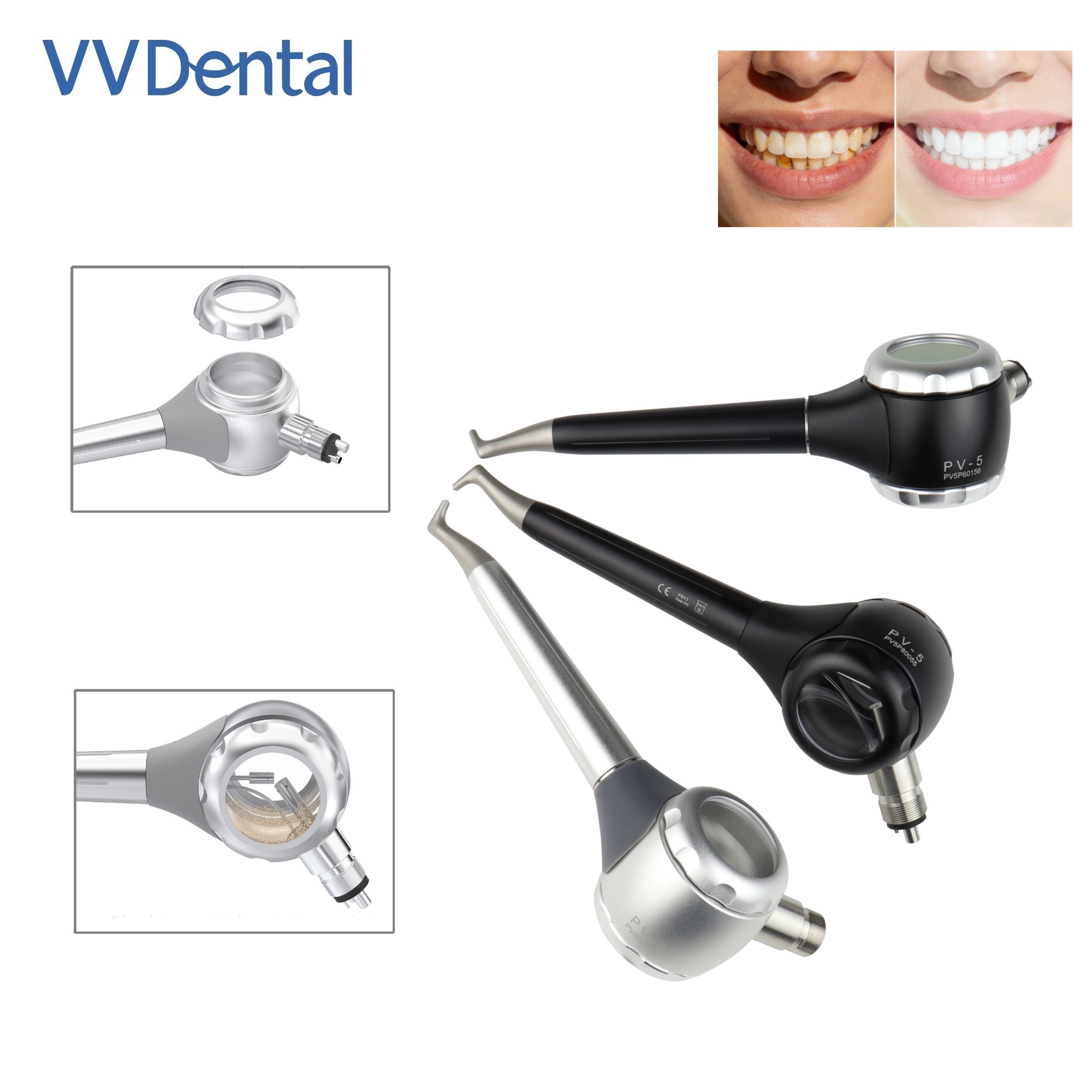 Pistola per Sabbiatura Dentale - Teeth Whitening Free recensione e prezzo