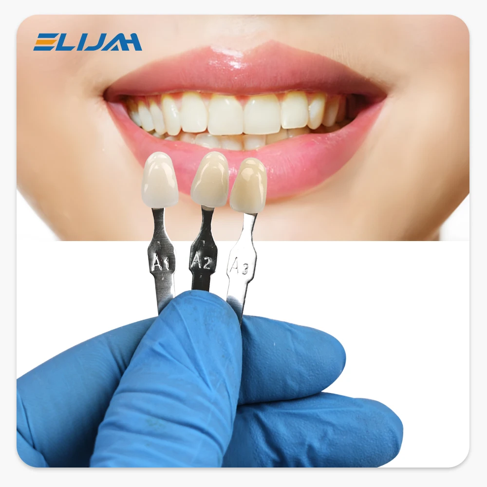 ELIJAH Master Guida per l'ombr - Teeth Whitening (Bleaching) recensione e prezzo