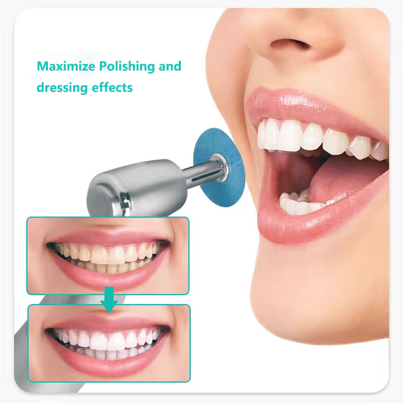 40 pz Dischi Per Lucidatura De - Teeth Whitening Professional recensione e prezzo
