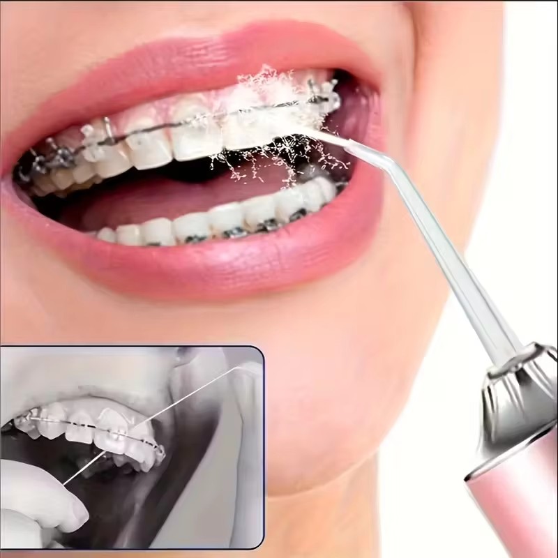 Irrigatore Orale, Idropulsore  - Whitening Mouthwash recensione e prezzo